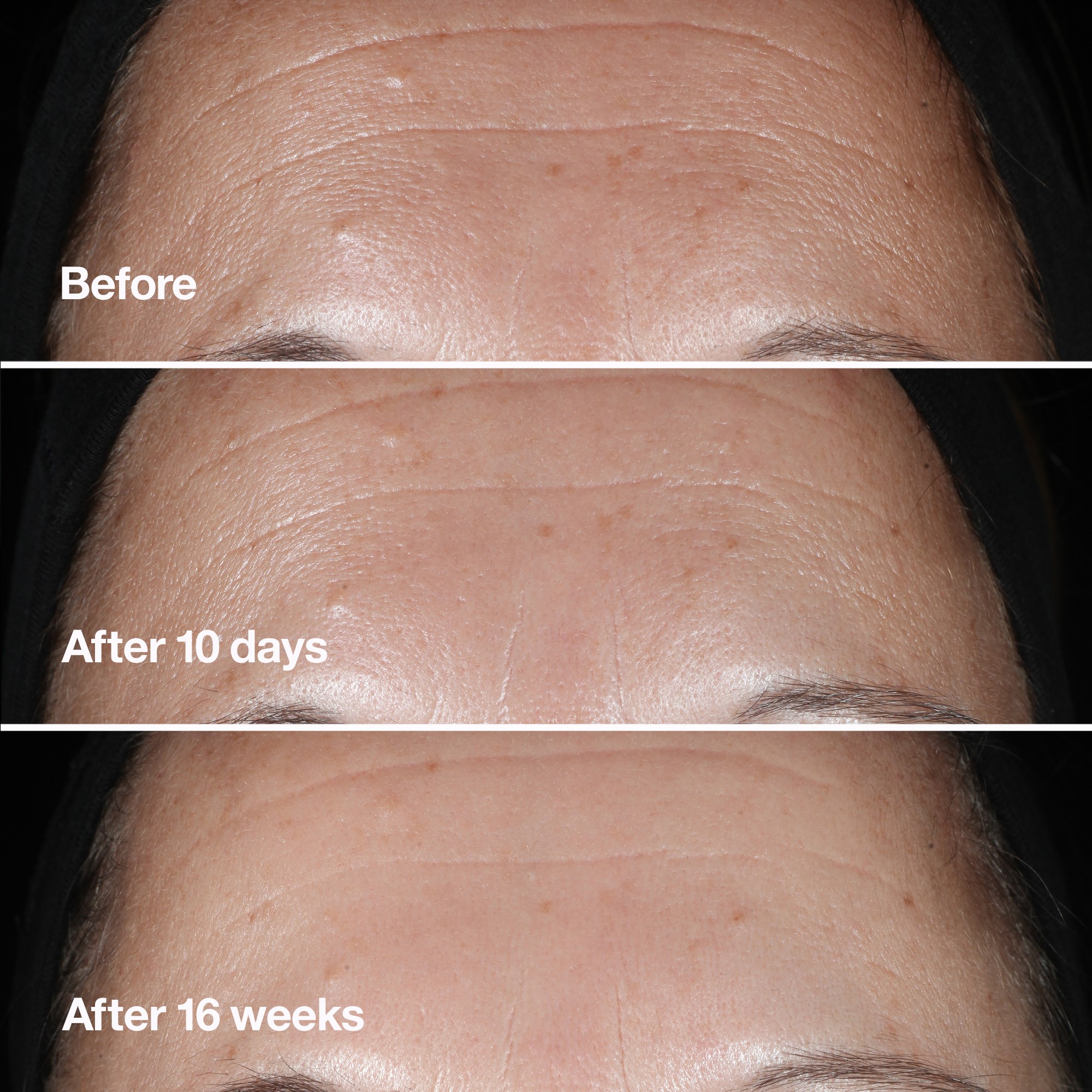 clinique_smart_clinical_repair_serum_30_ml_0192333101674_106973_3
