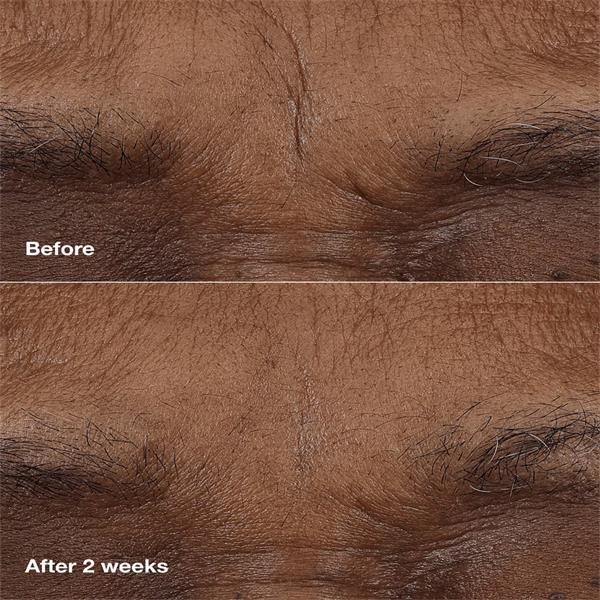 clinique_smart_clinical_repair_am_pm_retinoid_balm_serum_3_gr_0192333232323_870110_2
