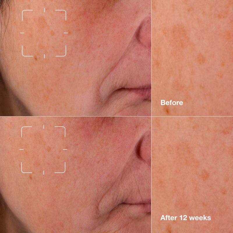 Clinique Even Better Clinical  Gezichtsserum 30 ml