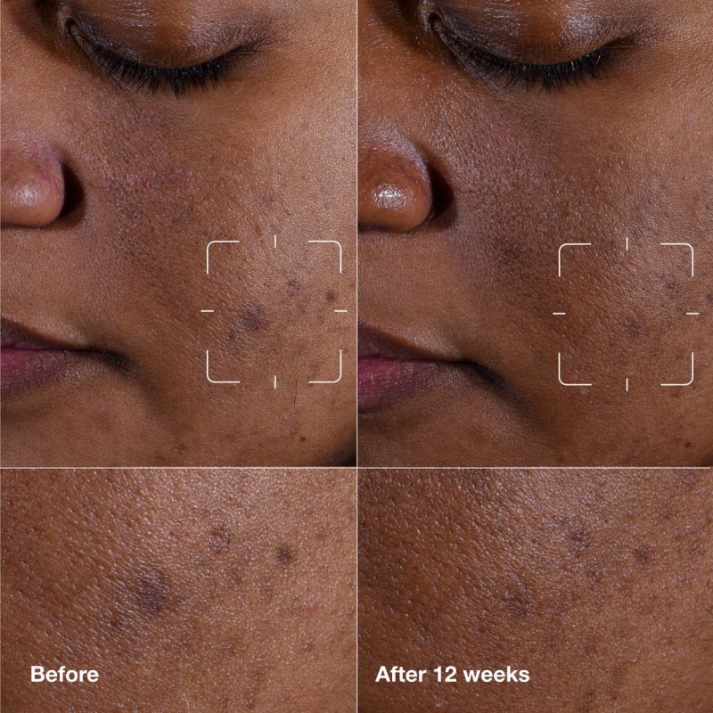 Clinique Even Better Clinical  Gezichtsserum 30 ml