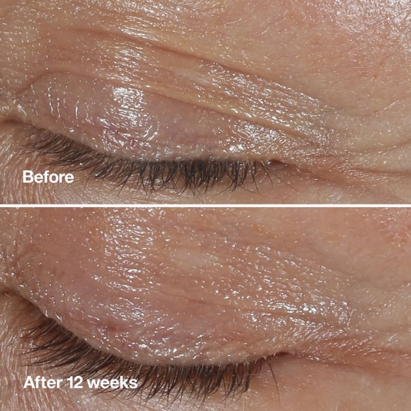 clinique_smart_clinical_repair_wrinkle_eye_cream_15_ml_0192333102749_119927_2