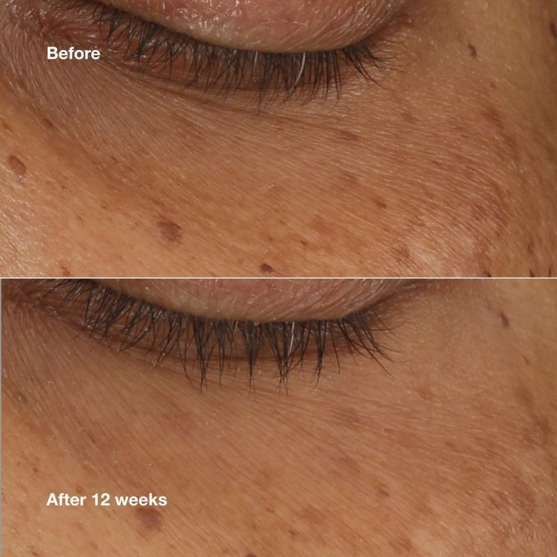 clinique_all_about_eyes_brightening_serum_concentrate_oogserum_10_ml_0192333237007_870124_1